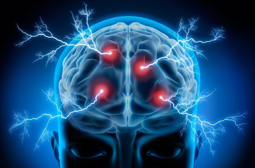 brain electricity smaller