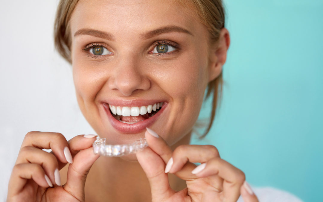 How To Get the Best Price on Invisalign?